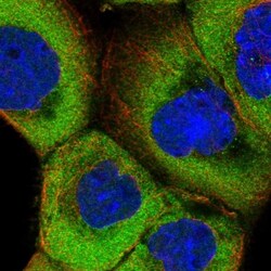 TXNDC9 Antibody, Novus Biologicals 25 &mu;L; Unlabeled:Antibodies, Polyclonal